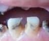 dentalboy
